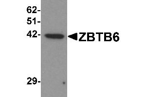 anti-Zinc Finger and BTB Domain Containing 6 (ZBTB6) (Middle Region) antibody