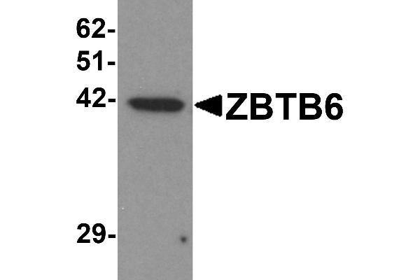 anti-Zinc Finger and BTB Domain Containing 6 (ZBTB6) (Middle Region) antibody