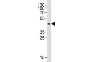 Image no. 1 for anti-Chemokine (C-C Motif) Receptor 2 (CCR2) (AA 336-369) antibody (ABIN3028567)
