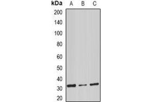 Image no. 2 for anti-Stomatin (STOM) antibody (ABIN2967073)