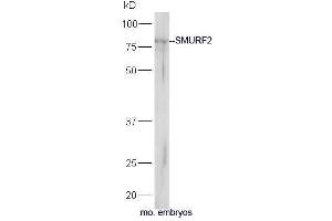 Image no. 3 for anti-SMAD Specific E3 Ubiquitin Protein Ligase 2 (SMURF2) (AA 601-700) antibody (ABIN753178)