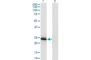 Image no. 1 for anti-Bridging Integrator 3 (BIN3) (AA 154-253) antibody (ABIN527796)