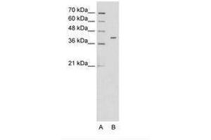 Image no. 1 for anti-Pregnancy Specific beta-1-Glycoprotein 6 (PSG6) (AA 51-100) antibody (ABIN6736625)