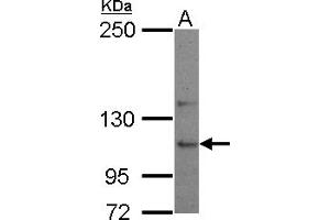 Image no. 1 for anti-Ubiquitin Specific Peptidase 26 (USP26) (C-Term) antibody (ABIN1491907)