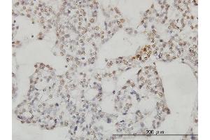 Immunoperoxidase of monoclonal antibody to SESN2 on formalin-fixed paraffin-embedded human ovary, clear cell carcinoma.