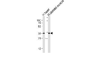 Image no. 1 for anti-Deiodinase, Iodothyronine, Type II (DIO2) (AA 165-191) antibody (ABIN5531011)