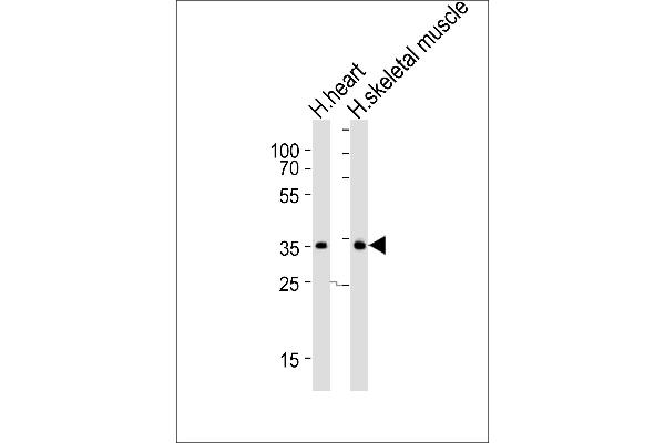anti-Deiodinase, Iodothyronine, Type II (DIO2) (AA 165-191) antibody