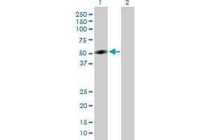 Image no. 1 for anti-Cytokine Receptor-Like Factor 1 (CRLF1) (AA 1-422) antibody (ABIN522719)
