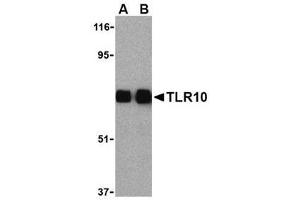 Image no. 1 for anti-Toll-Like Receptor 10 (TLR10) (Internal Region) antibody (ABIN6655319)
