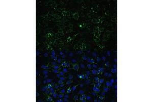 ALDH1A2 antibody  (AA 1-180)
