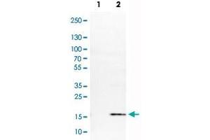 Image no. 2 for anti-S100 Calcium Binding Protein A4 (S100A4) antibody (ABIN5650195)