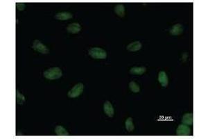Image no. 2 for anti-Small Nuclear RNA Activating Complex, Polypeptide 1, 43kDa (SNAPC1) antibody (ABIN931162)