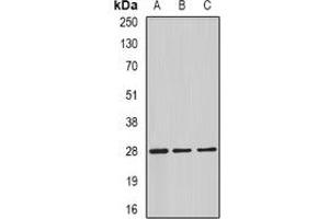 Image no. 3 for anti-Complement Component 4 Binding Protein, beta (C4BPB) antibody (ABIN2966480)