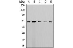 Image no. 1 for anti-StAR-Related Lipid Transfer (START) Domain Containing 3 (STARD3) (full length) antibody (ABIN6006142)