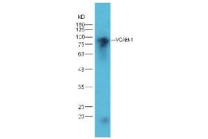 Image no. 4 for anti-Vascular Cell Adhesion Molecule 1 (VCAM1) (AA 651-739) antibody (ABIN729838)