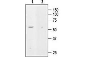 anti-Potassium Channel, Subfamily K, Member 5 (KCNK5) (AA 483-499), (C-Term), (Intracellular) antibody