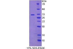 Image no. 1 for Protein Tyrosine Phosphatase, Receptor Type, Q (PTPRQ) (AA 36-294) protein (His tag) (ABIN6237882)