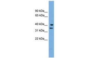 Image no. 1 for anti-Proline Rich Nuclear Receptor Coactivator 1 (PNRC1) (AA 179-228) antibody (ABIN6744955)