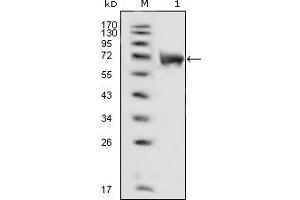 Image no. 1 for anti-Fibroblast Growth Factor Receptor 1 (FGFR1) (AA 22-376) antibody (ABIN969138)