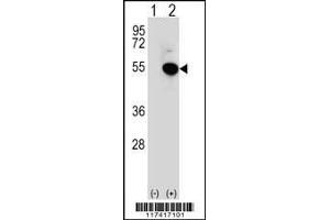 Image no. 2 for anti-Interferon Regulatory Factor 4 (IRF4) (AA 164-191) antibody (ABIN3031420)