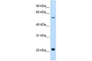 Image no. 3 for anti-Solute Carrier Family 17 (Acidic Sugar Transporter), Member 5 (SLC17A5) antibody (ABIN635267)