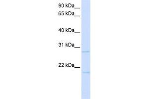 Image no. 1 for anti-Transcription Factor 21 (TCF21) (C-Term) antibody (ABIN2780489)