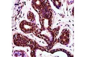 PDCD4 antibody immunohistochemistry analysis in formalin fixed and paraffin embedded human breast tissue.