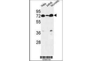 Image no. 1 for anti-Lipid Phosphate Phosphatase-Related Protein Type 4 (LPPR4) (AA 666-695), (C-Term) antibody (ABIN651164)