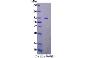 Image no. 1 for High Mobility Group 20B (HMG20B) (AA 1-213) protein (His tag) (ABIN6239327)