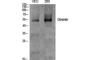 Image no. 2 for anti-Desmin (DES) (C-Term) antibody (ABIN3184287)