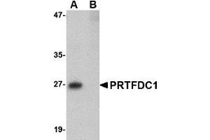 Image no. 1 for anti-phosphoribosyl Transferase Domain Containing 1 (PRTFDC1) (Middle Region) antibody (ABIN1031049)