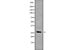 Image no. 1 for anti-Sodium Channel Modifier 1 (SCNM1) antibody (ABIN6264944)