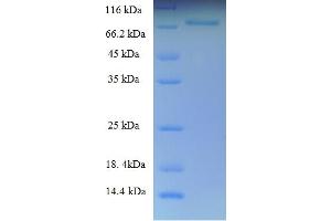 Image no. 1 for Keratin 8 (KRT8) (AA 2-483) protein (His-SUMO Tag) (ABIN5709835)