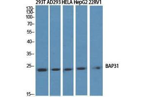 Image no. 2 for anti-B-Cell Receptor-Associated Protein 31 (BCAP31) (Internal Region) antibody (ABIN3183480)