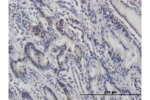 Immunohistochemistry (IHC) image for anti-Tumor Protein P53 (TP53) (pSer46) antibody (ABIN3201005)