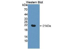Image no. 2 for anti-phospholipase C, beta 3 (Phosphatidylinositol-Specific) (PLCB3) (AA 318-468) antibody (ABIN5014109)