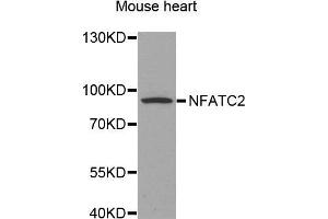 NFAT1 抗体