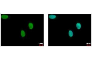 Image no. 1 for anti-BRCA1 Interacting Protein C-terminal Helicase 1 (BRIP1) (N-Term) antibody (ABIN2857051)