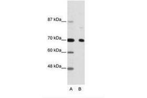Image no. 1 for anti-Nuclear Receptor Co-Repressor 2 (NCOR2) (AA 541-590) antibody (ABIN202991)