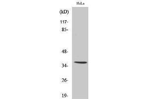 Image no. 1 for anti-IgA (Internal Region) antibody (ABIN3185132)