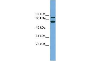 Image no. 2 for anti-YY1 Associated Protein 1 (YY1AP1) (Middle Region) antibody (ABIN2784323)
