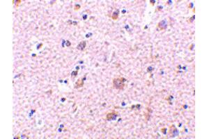 Image no. 2 for anti-Mesencephalic Astrocyte-Derived Neurotrophic Factor (MANF) (N-Term) antibody (ABIN6656565)