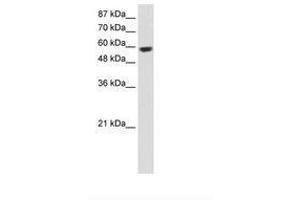 Image no. 2 for anti-Ring Finger Protein 14 (RNF14) (C-Term) antibody (ABIN203171)