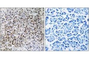 Image no. 2 for anti-Mitochondrial Ribosomal Protein L40 (MRPL40) (AA 101-150) antibody (ABIN1534529)