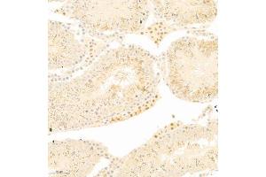 GFR antibody