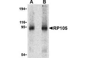 Western Blotting (WB) image for anti-CD180 Molecule (CD180) (Middle Region) antibody (ABIN1031073)