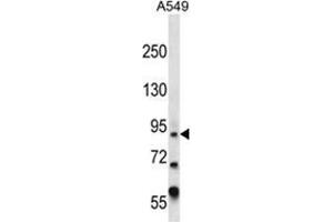 Image no. 1 for anti-Zinc Finger Protein, Y-Linked (ZFY) (AA 322-351), (Middle Region) antibody (ABIN955665)