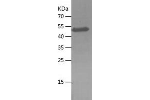 MAGEC2 Protein (AA 1-145) (His-IF2DI Tag)