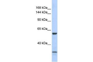 Image no. 1 for anti-Zinc Finger Protein 777 (ZNF777) (N-Term) antibody (ABIN2780979)