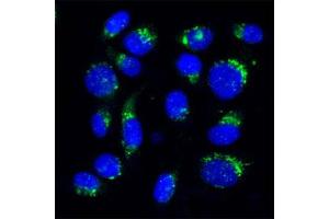Image no. 1 for anti-USO1 Homolog, Vesicle Docking Protein (USO1) (Internal Region) antibody (ABIN351345)